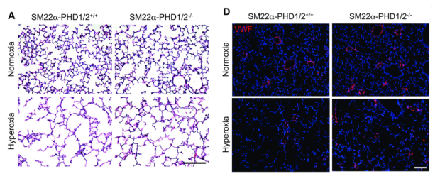 SM22 cell specific HIF-1 stabilization mitigates the effects of hyperoxia-induced neonatal lung injury. 